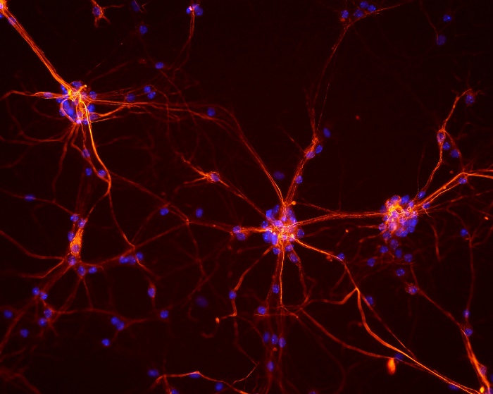 Image of Neurons from the spinal cord