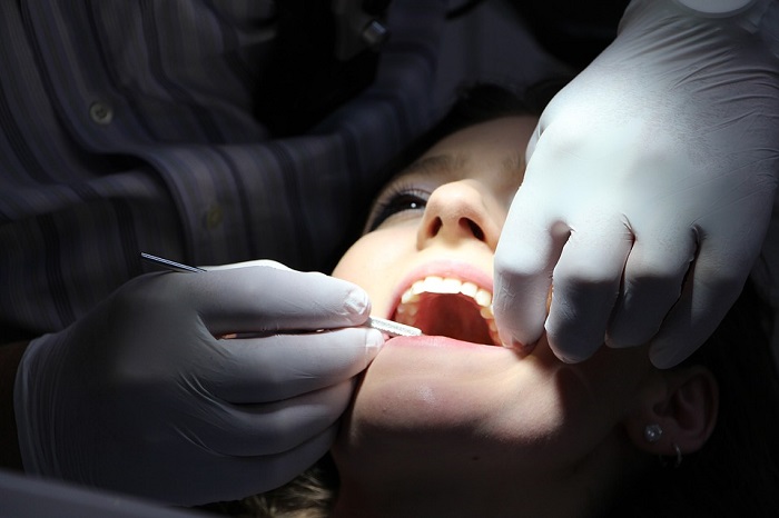 Image of a dentist examining someones mouth